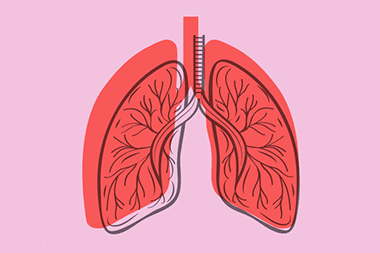 graphic illustration of lungs with a ladder for a trachea