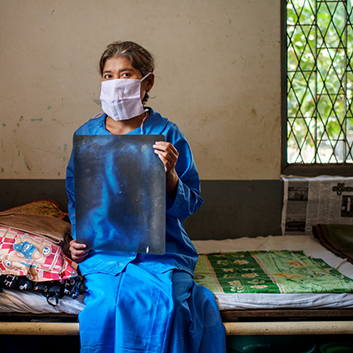 A patient holds an x-ray photo of her chest, Myanmar. Photo: The Global Fund/Jonas Gratzer